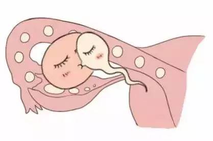 单身生子助孕机构